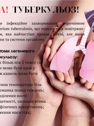 Всесвітній день боротьби проти туберкульозу